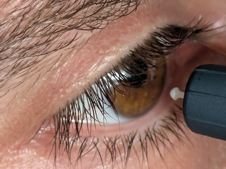 SehVia Service – Augeninnendruckmessung beim Hausbesuch Augeninnendruckmessung vor Ort – SehVia mobiler Optiker Leipzig